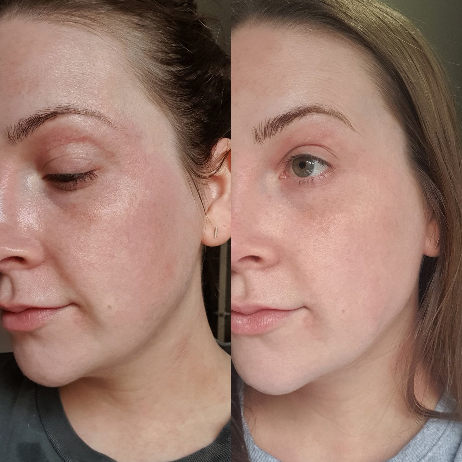 My Skincare Journey: Why I Started The Facial Co. Skincare