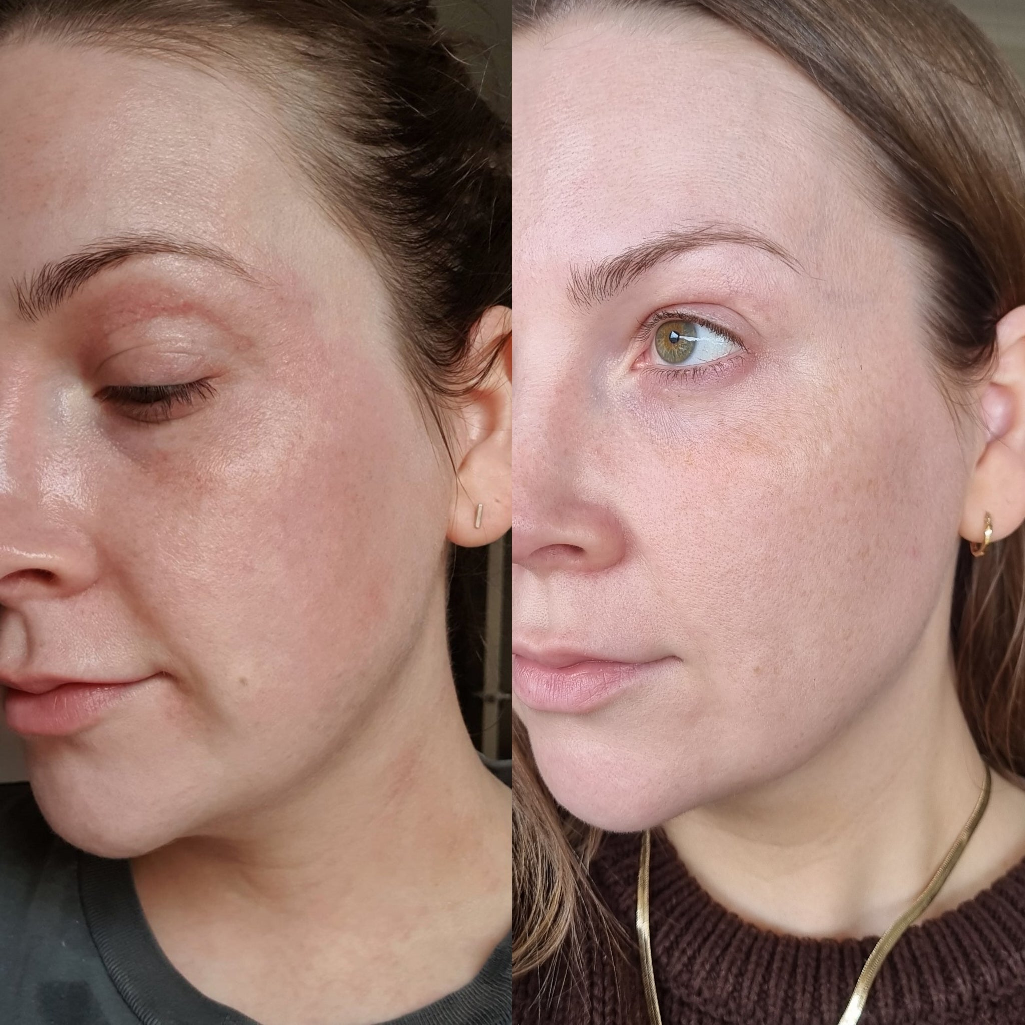 My Skincare Journey: Why I Started The Facial Co. Skincare